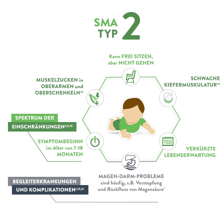 SMA bei Kindern