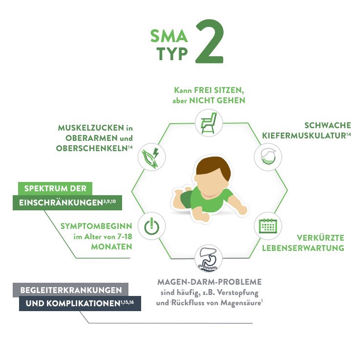 SMA bei Kindern